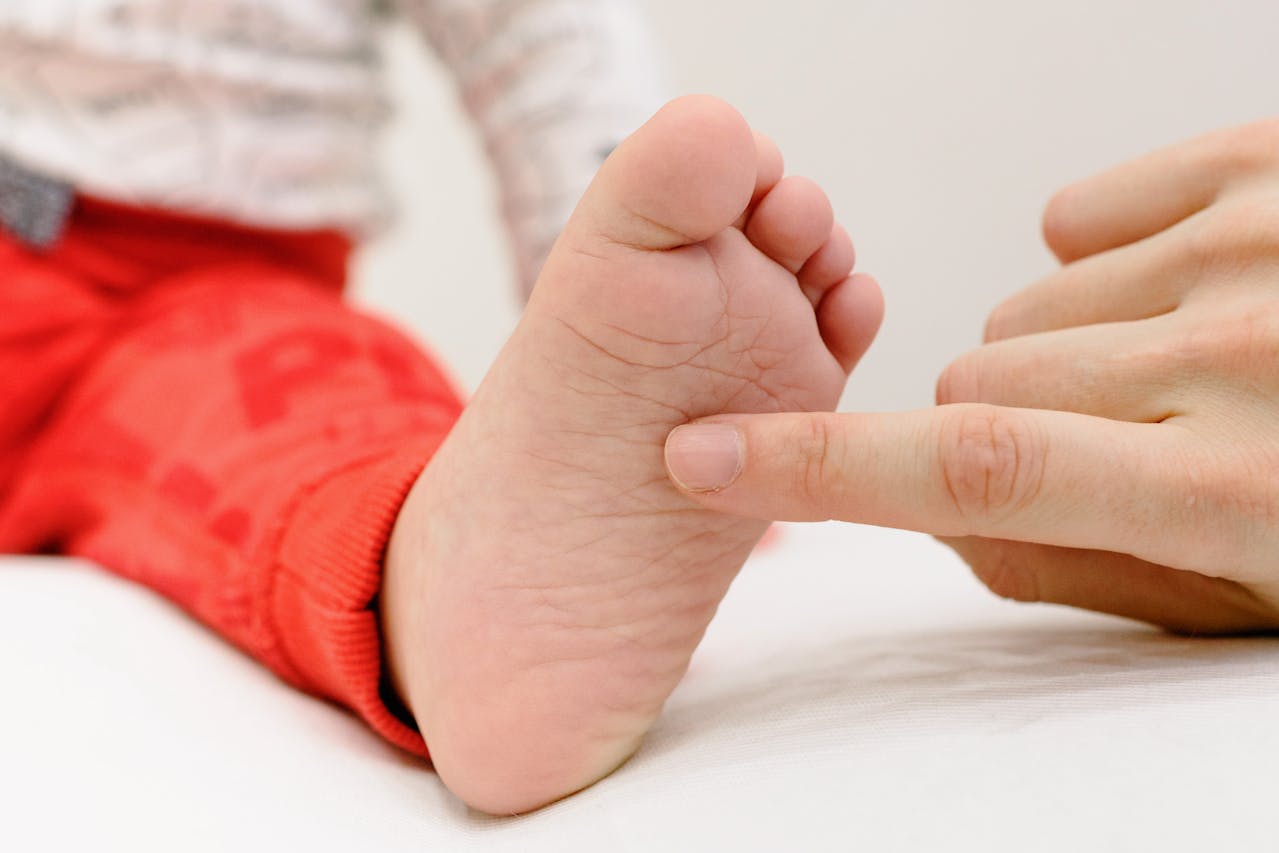 hand foot and mouth disease